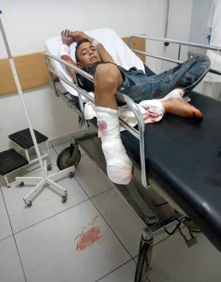 Un jeune homme blessé dans l'explosion d'une mine à Wadi Khaled