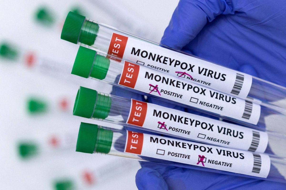 Variole du singe : l'OMS soupçonne une 