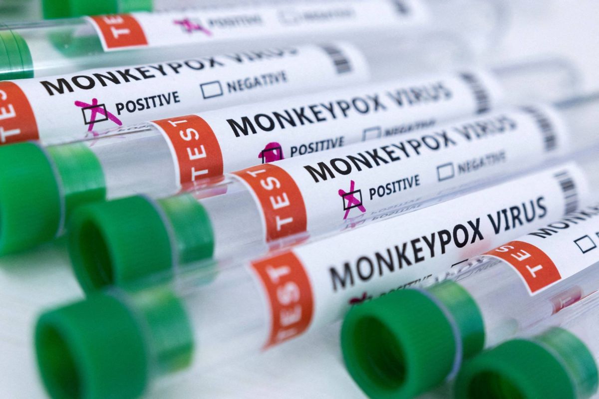 Variole du singe : 780 cas dans les pays non endémiques, selon l'OMS
