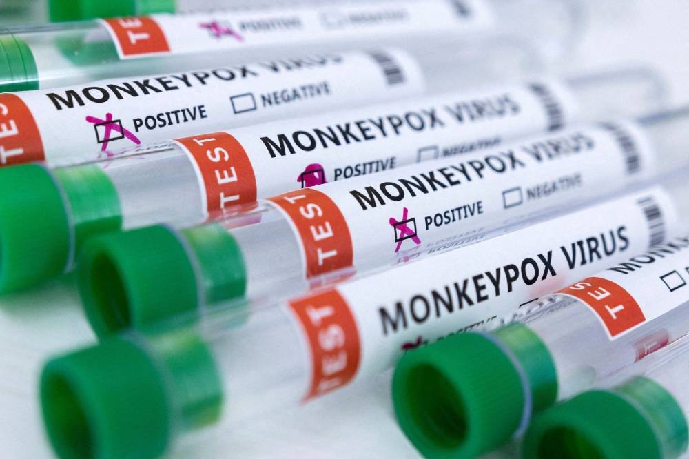 Variole du singe : des échantillons de cas suspects au Liban envoyés en France