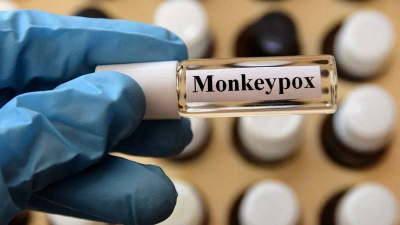 Un premier cas de variole du singe détecté au Liban