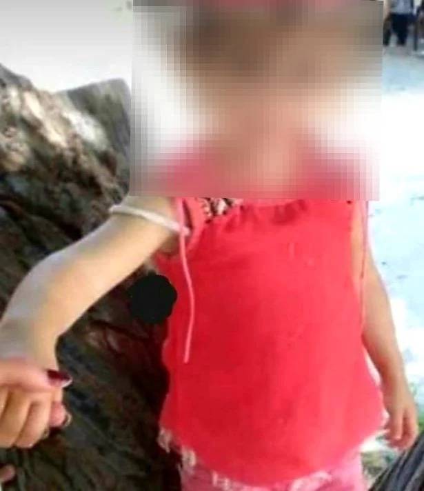 Girl, aged 3, dies after being stung by scorpion