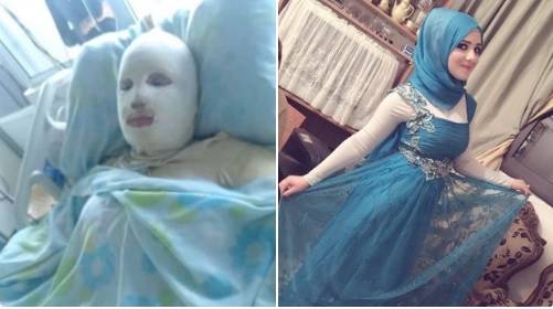 Brûlée vive par son mari, Hanaa Khaled a succombé à ses blessures