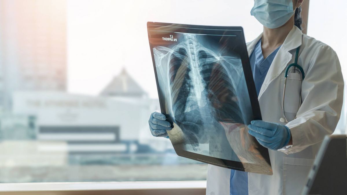 Mucoviscidose : un nouveau traitement change la vie de certains malades