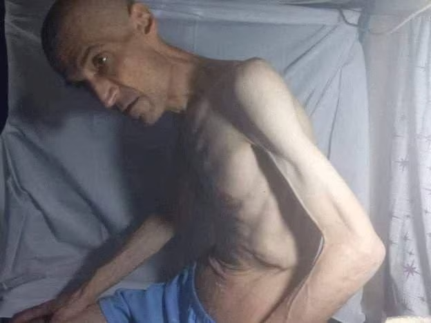 Iran releases emaciated dissident after long hunger strike: judiciary Iran releases emaciated dissident after long hunger strike: judiciary
