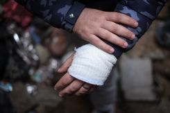 Omar Barakat, a resident of Mina, shows the injury he suffered after his balcony collapse following the earthquake, Feb. 9, 2023. (Credit: João Sousa/L'Orient Today)