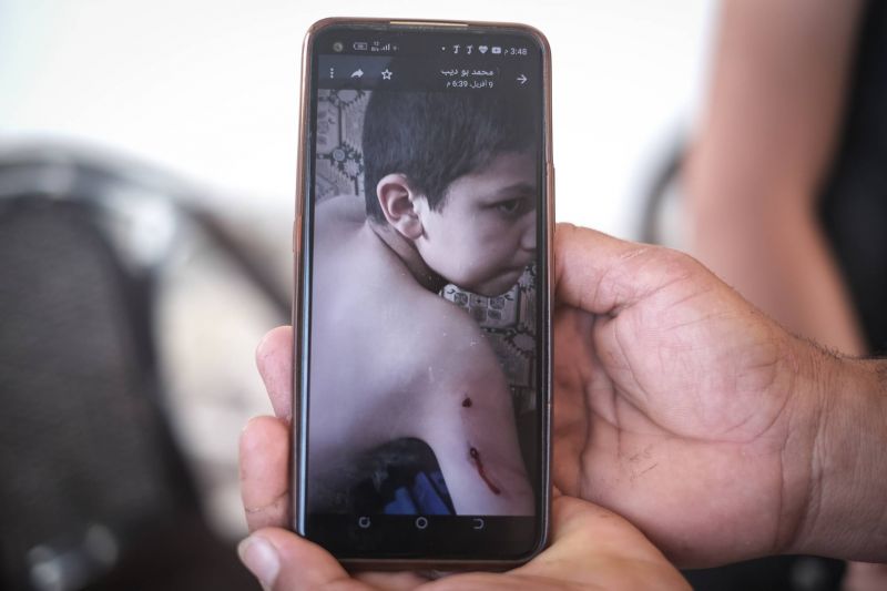 Wassim Hafezeh, 13 ans, une balle dans le bras