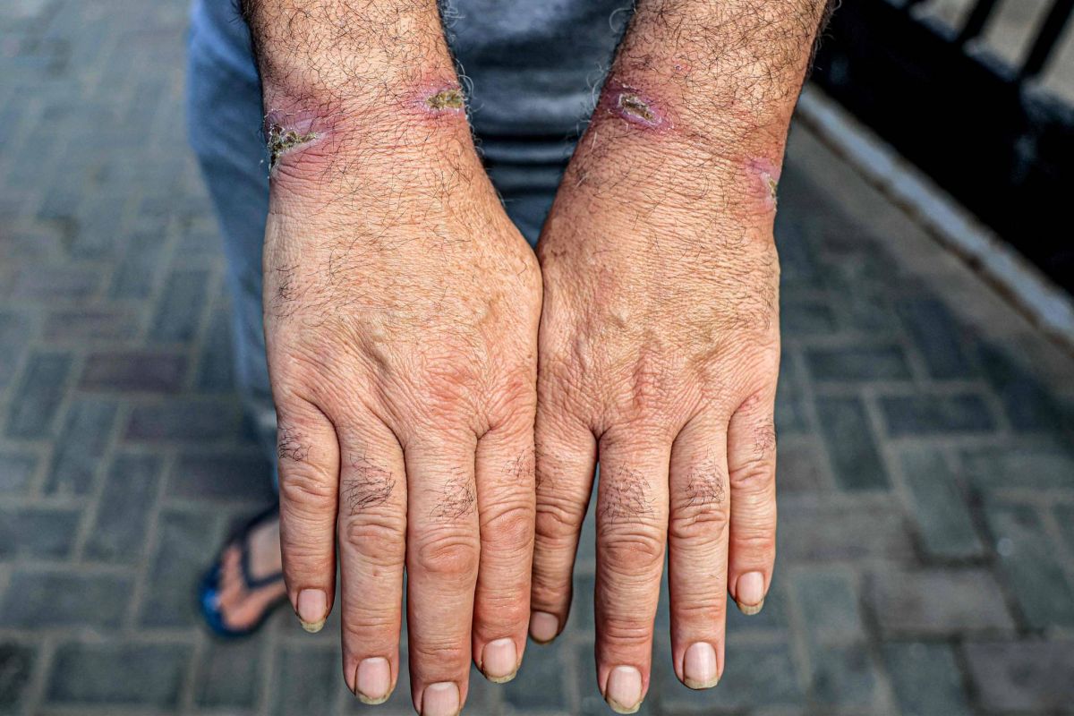 Des Palestiniens libérés par Israël affirment avoir été torturés