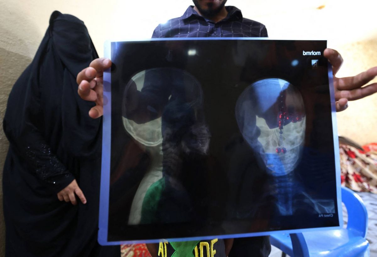 Iraq counts cost of stray bullets fired in anger or joy