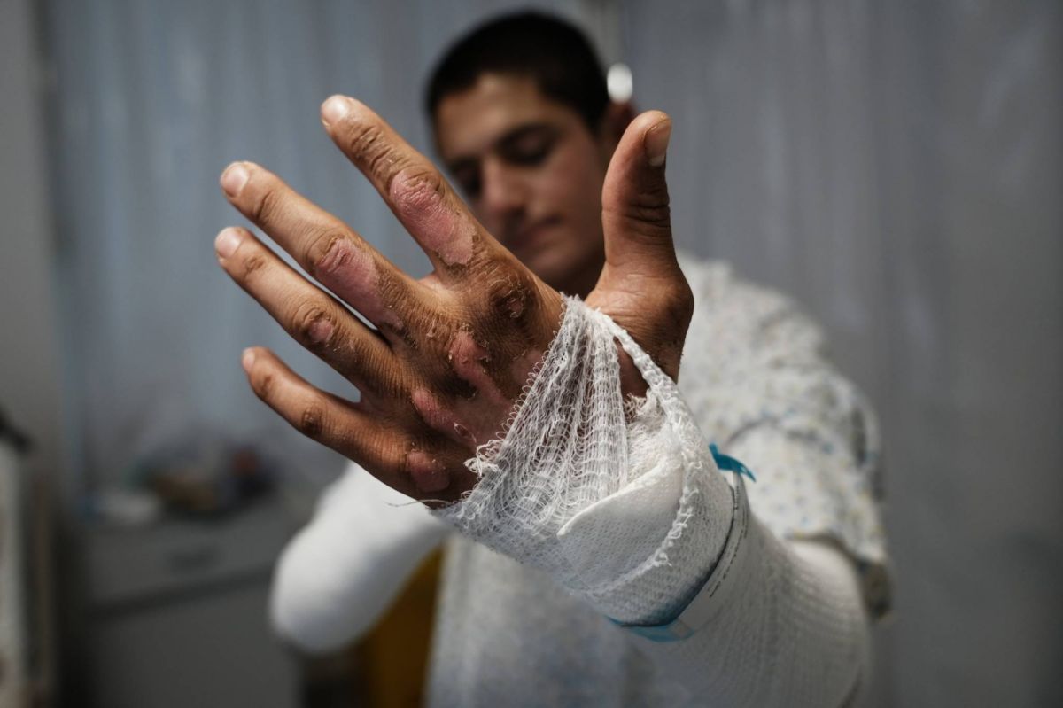 Hidden toll: South Lebanon's civilians bear scars of conflict