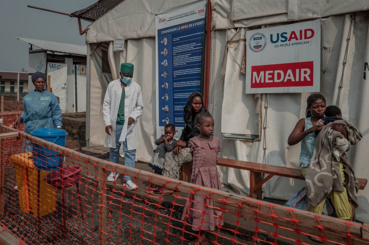 Mpox : 171 cas recensés au Burundi Mpox : 171 cas recensés au Burundi
