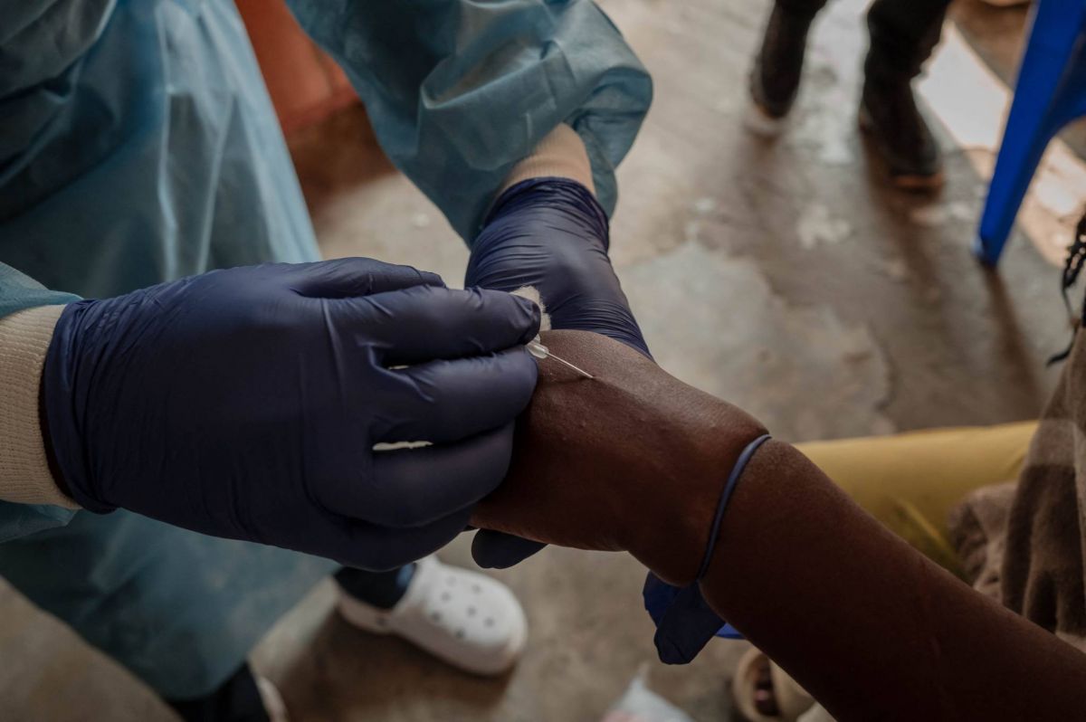 Mpox : une déferlante de fausses informations après l’alerte de l’OMS