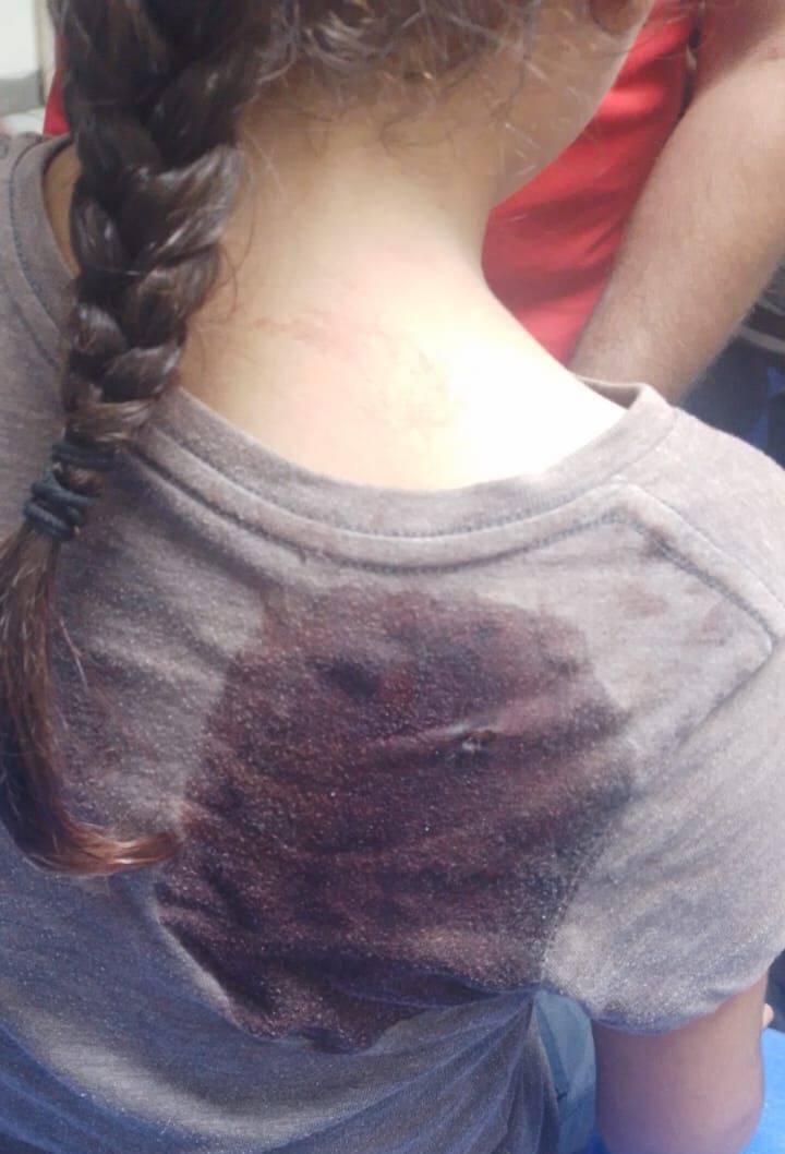 Une enfant blessée par une balle perdue à Bebnine, au Akkar
