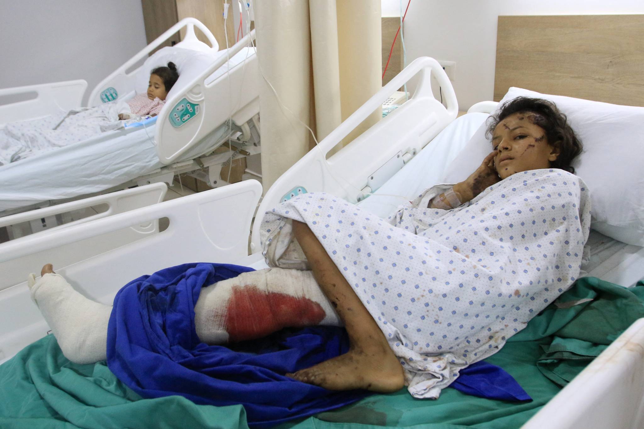 Le bilan de cette journée est extrêmement lourd : 492 morts, dont 35 enfants et 58 femmes, et 1 645 blessés, parmi lesquels ces deux enfants se faisant soigner, le 24 septembre, dans le village de Saksakiyeh. Mahmoud Zayyat/AFP