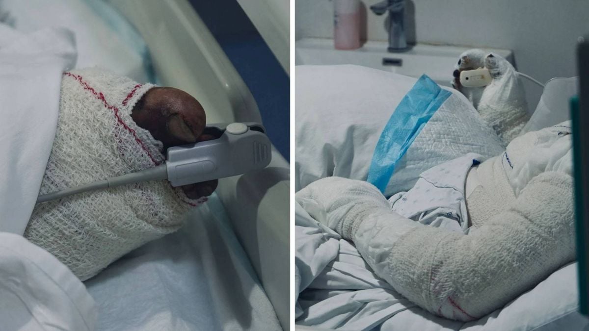 A cry for help for Lebanon’s burn victims A cry for help for Lebanon’s burn victims