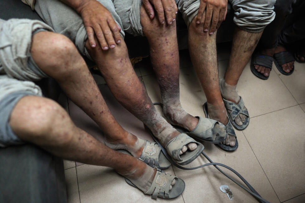 Dans les prisons israéliennes, la torture généralisée des détenus palestiniens Dans les prisons israéliennes, la torture généralisée des détenus palestiniens