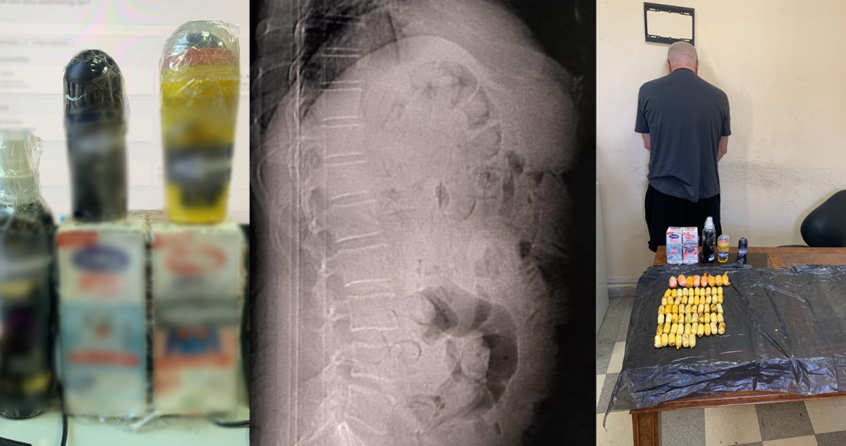 Lebanese police arrest trafficker with 65 capsules of cocaine in his stomach Lebanese police arrest trafficker with 65 capsules of cocaine in his stomach