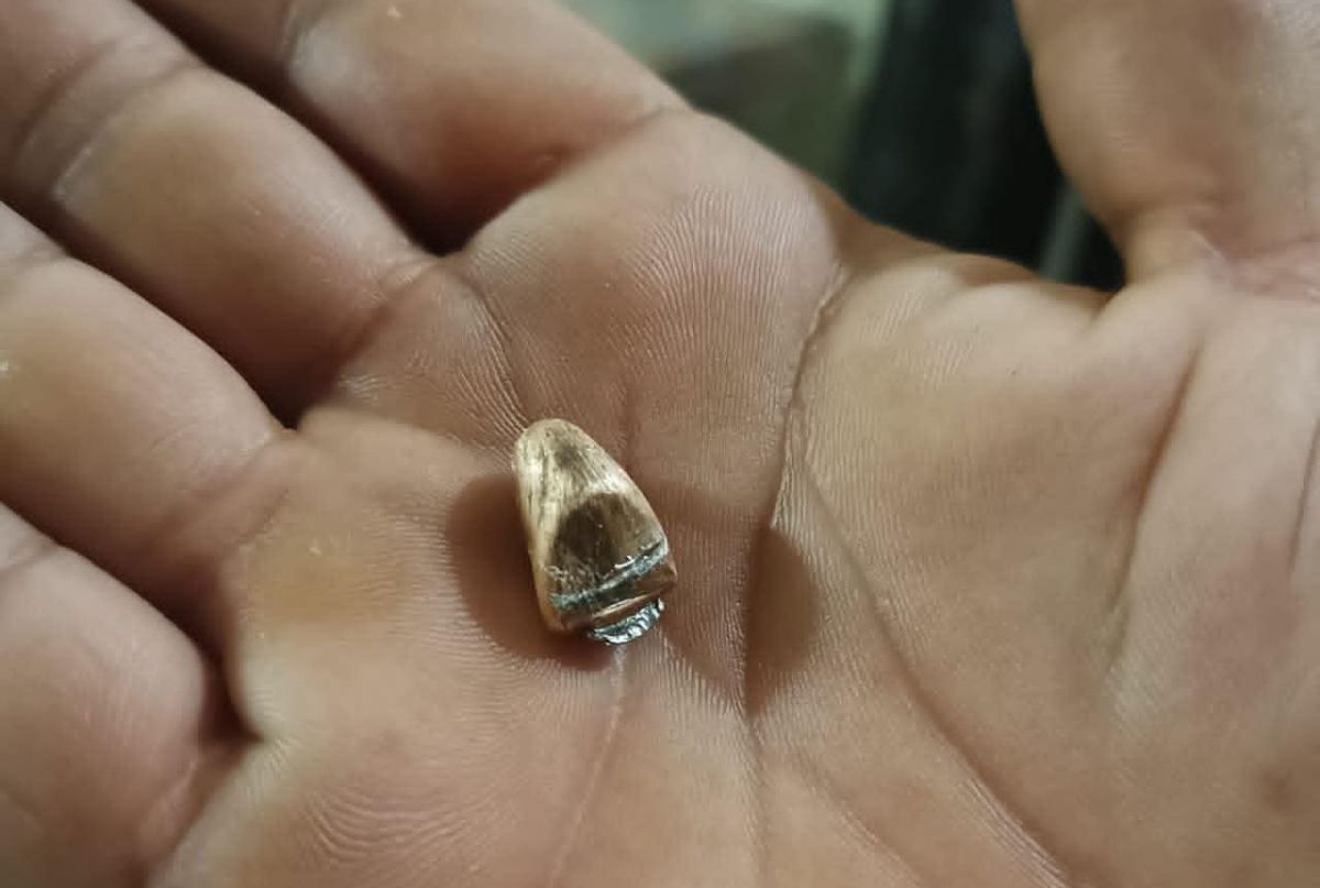 Liban-Nord : en 48 heures, trois femmes touchées par des balles perdues