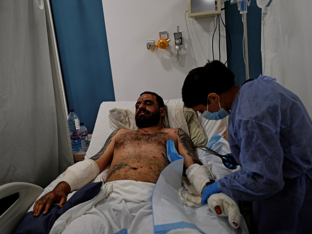 Mahmoud Sahmorani git sur son lit, dans le centre installé face à l’hôpital Najdeh du Secours populaire libanais, à l’entrée de Nabatiyé. Son bras est fracturé et il a le visage tuméfié. Jeudi soir, peu avant l’entrée en vigueur de la trêve, une frappe à détruit l’immeuble dans lequel il se trouvait, tuant son père, son oncle, son cousin et un voisin. Matthieu Karam / L'Orient-Le Jour